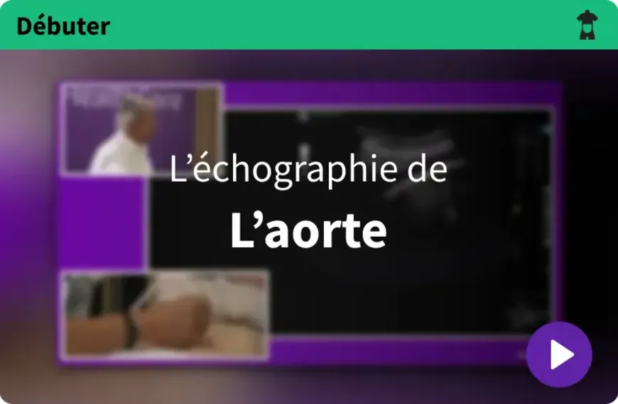 Débuter l'échographie abdominale en médecine générale : L’aorte [1/4]