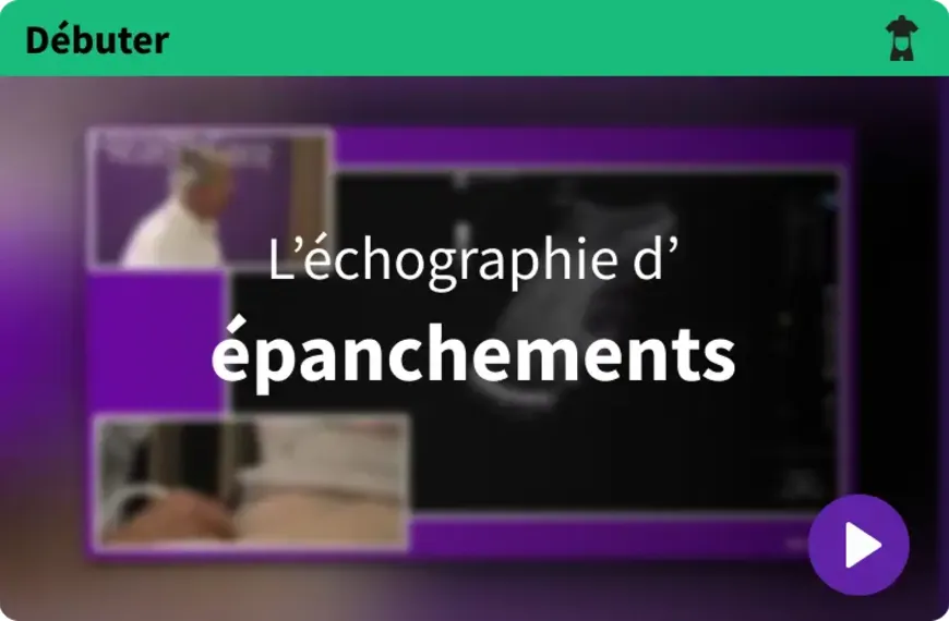Débuter l'échographie abdominale en médecine générale : Les épanchements [2/4]