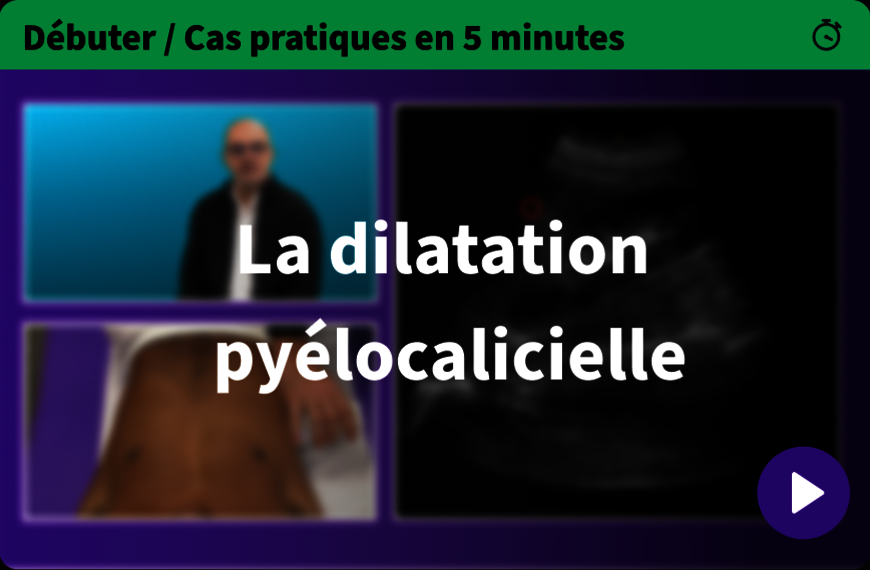 Échographie de la dilatation pyélocalicielle en médecine générale : guide clinique et protocole POCUS