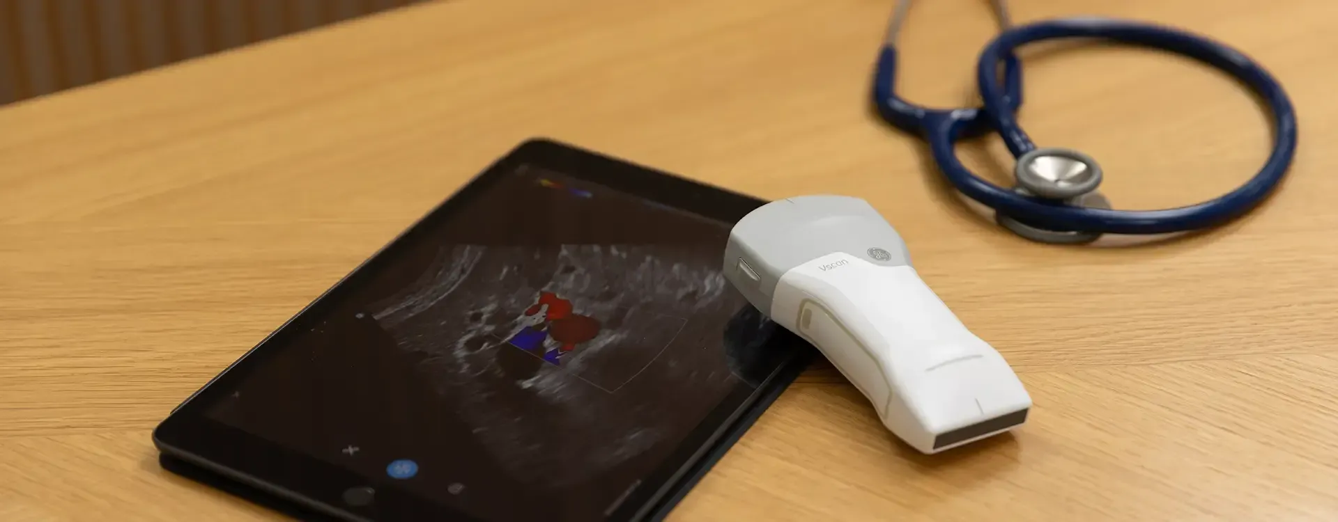 Quel échographe choisir pour un cabinet de médecine générale ?