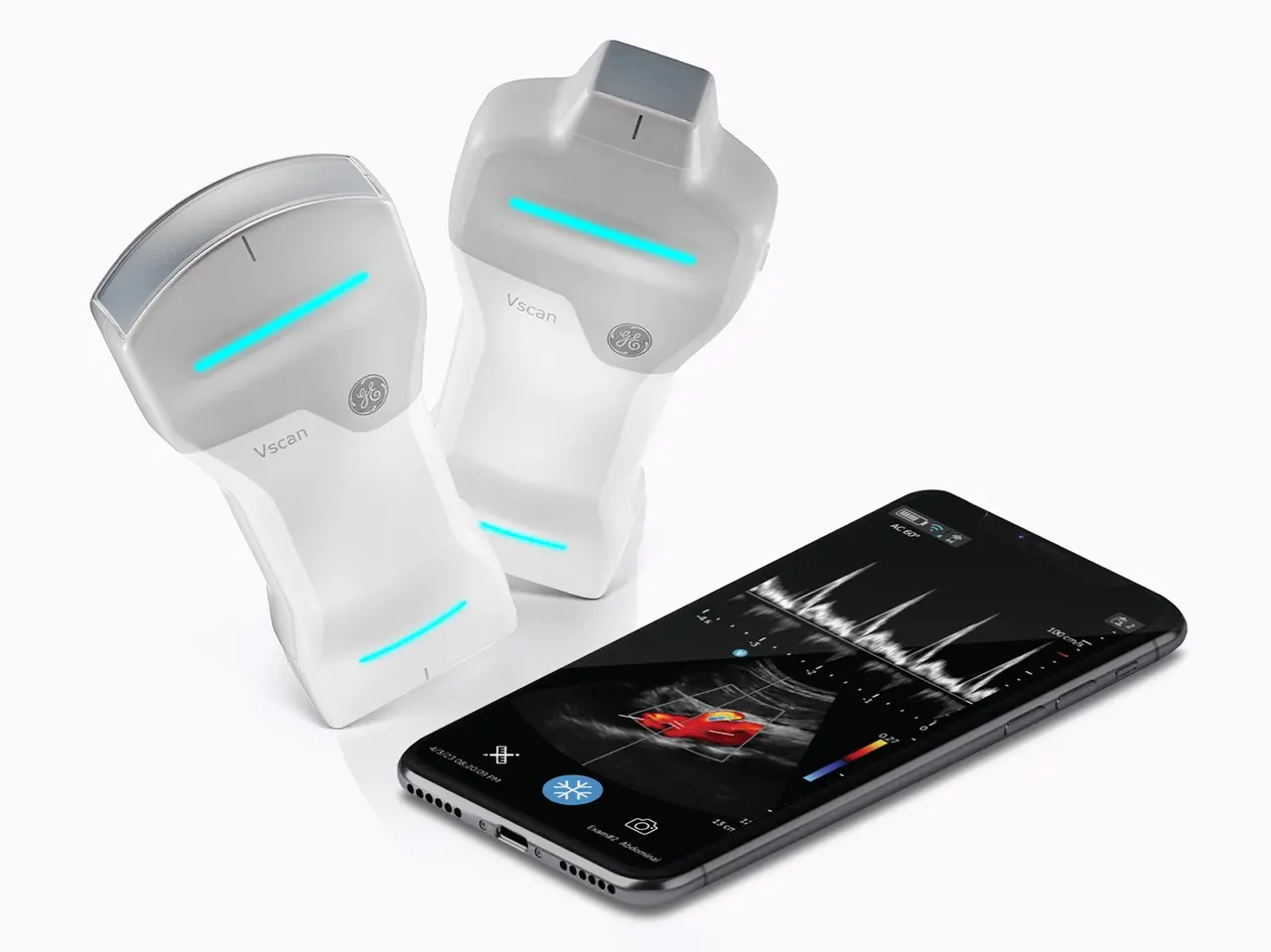 Des échographes adaptés à la médecine générale